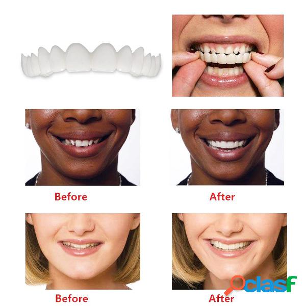 Kit de dientes falsos naturales Sonrisa Confort Carillas
