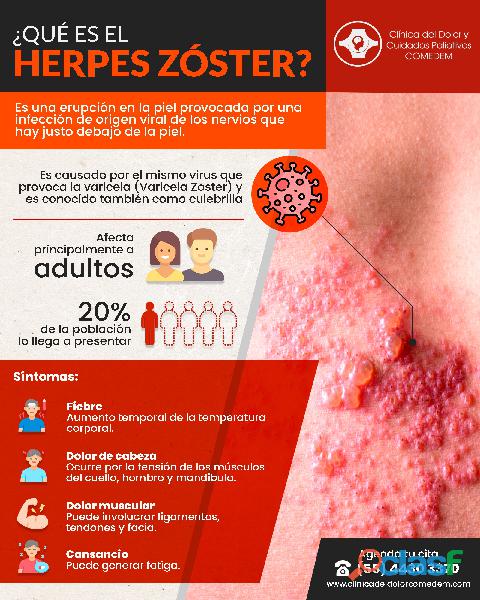 No sufras por el herpes Zóster